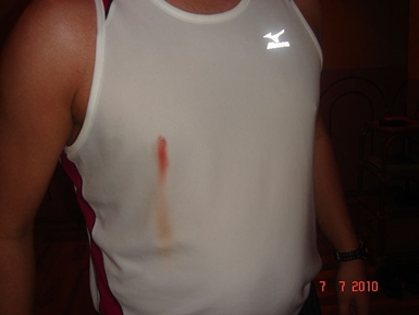 Runners Nipple, Bleeding